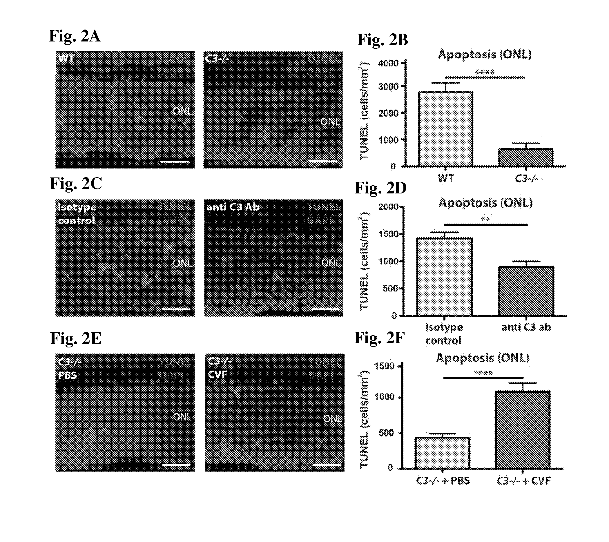 Methods of Preventing or Reducing Photoreceptor Cell Death