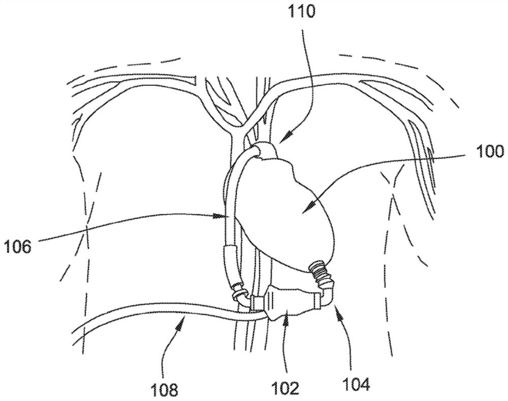 Vascular graft and methods for sealing a vascular graft