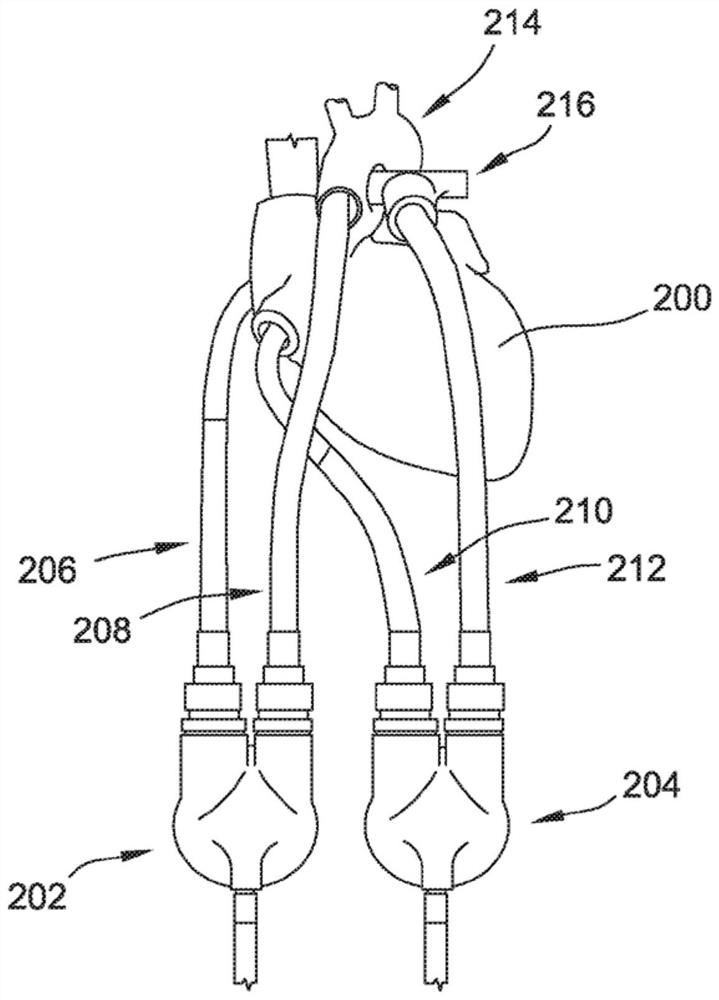 Vascular graft and methods for sealing a vascular graft