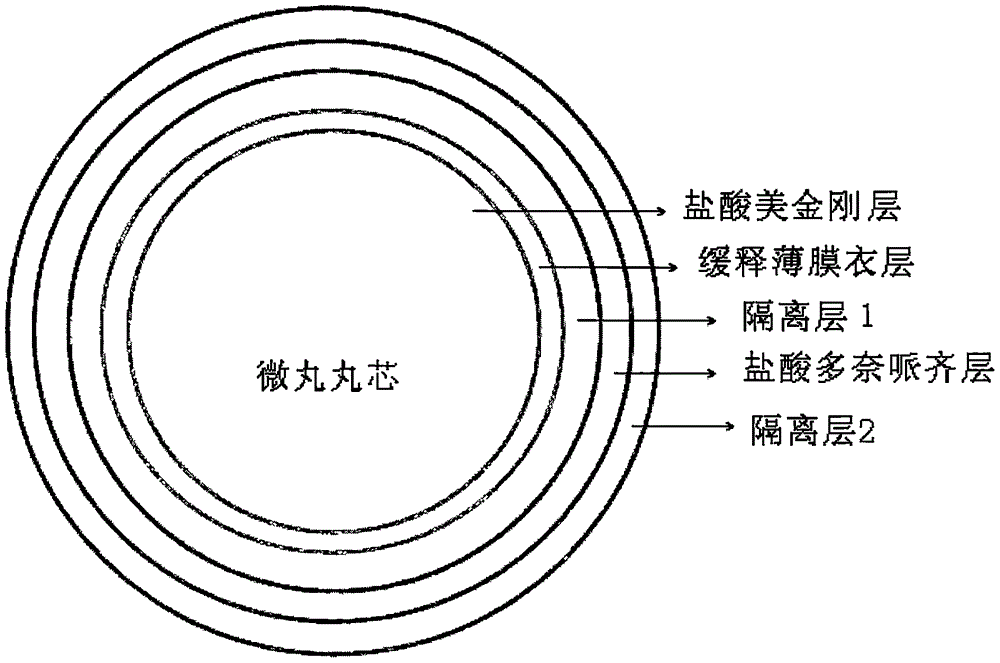 Memantine hydrochloride and donepezil hydrochloride composite preparation