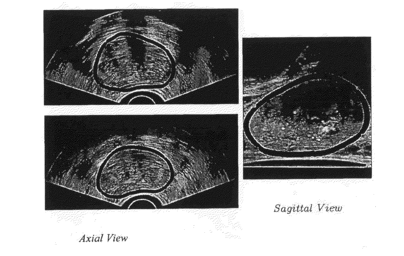 3D tissue model formation from non-parallel 2d images