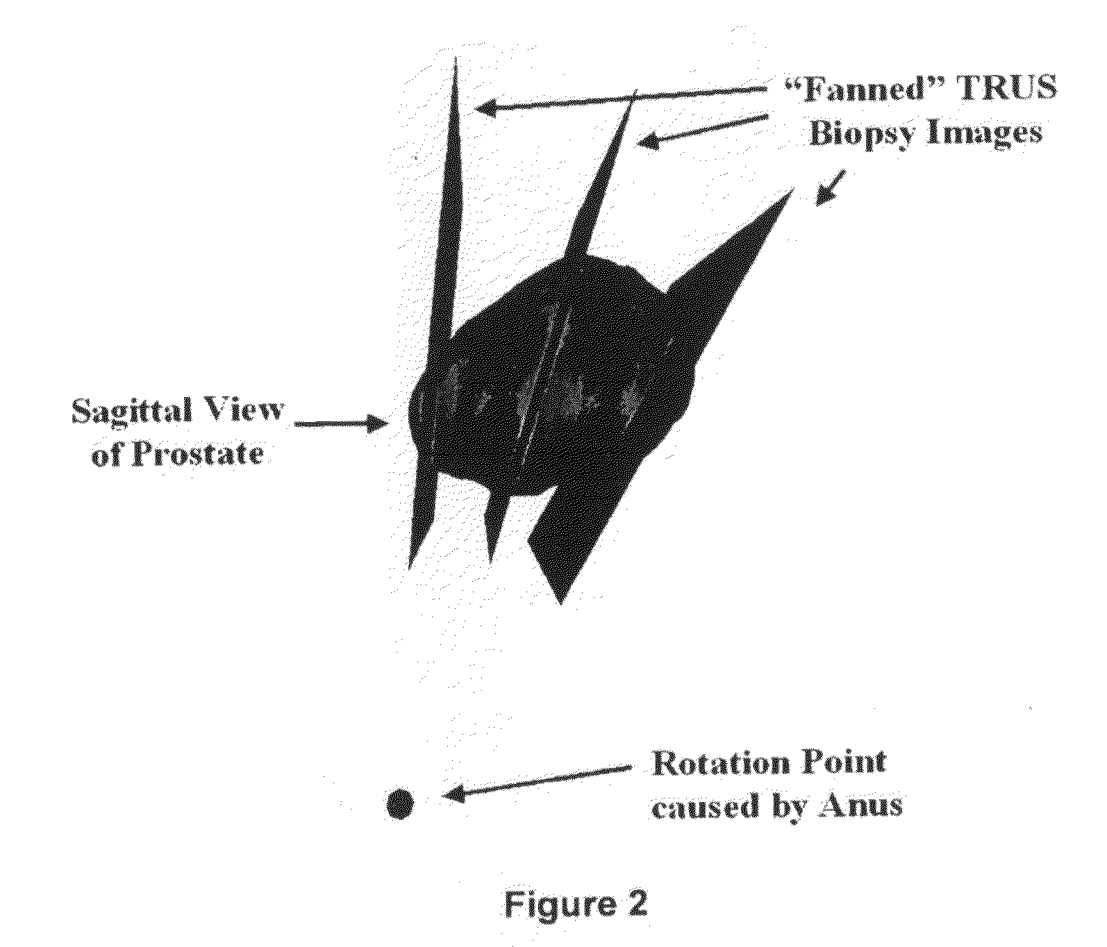 3D tissue model formation from non-parallel 2d images