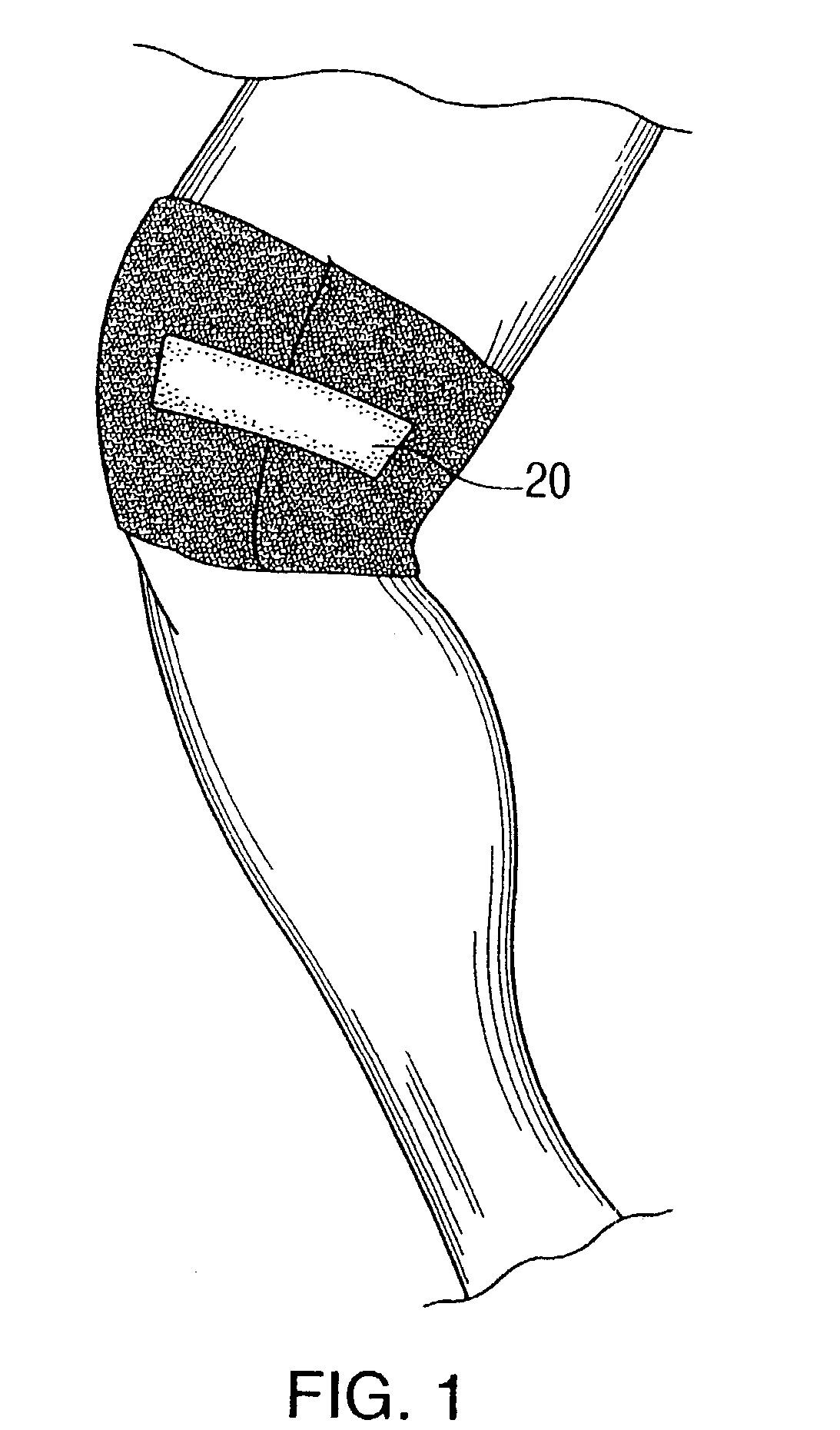 Gel wrap providing musculo-skeletal support