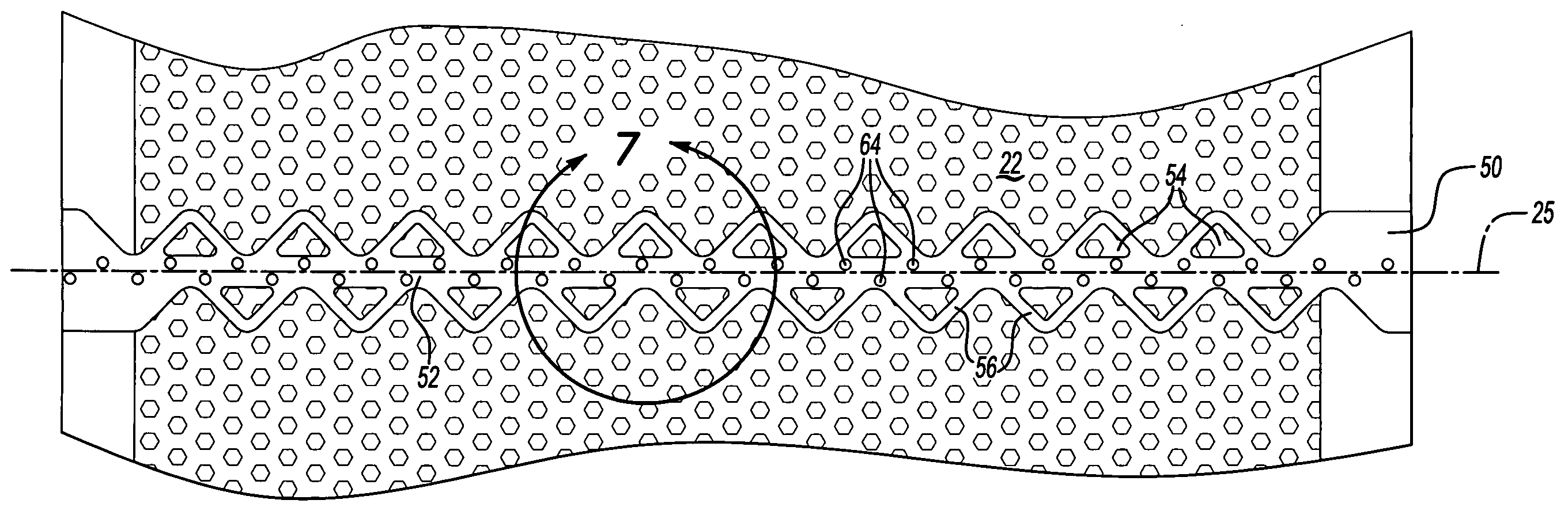 Acoustic mechanical retainer