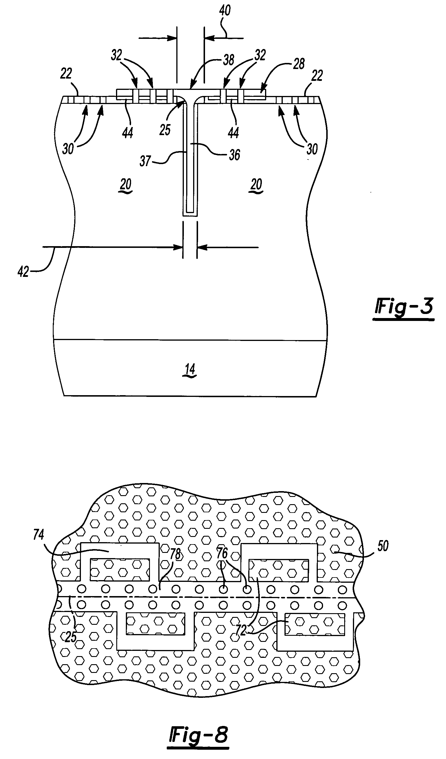 Acoustic mechanical retainer