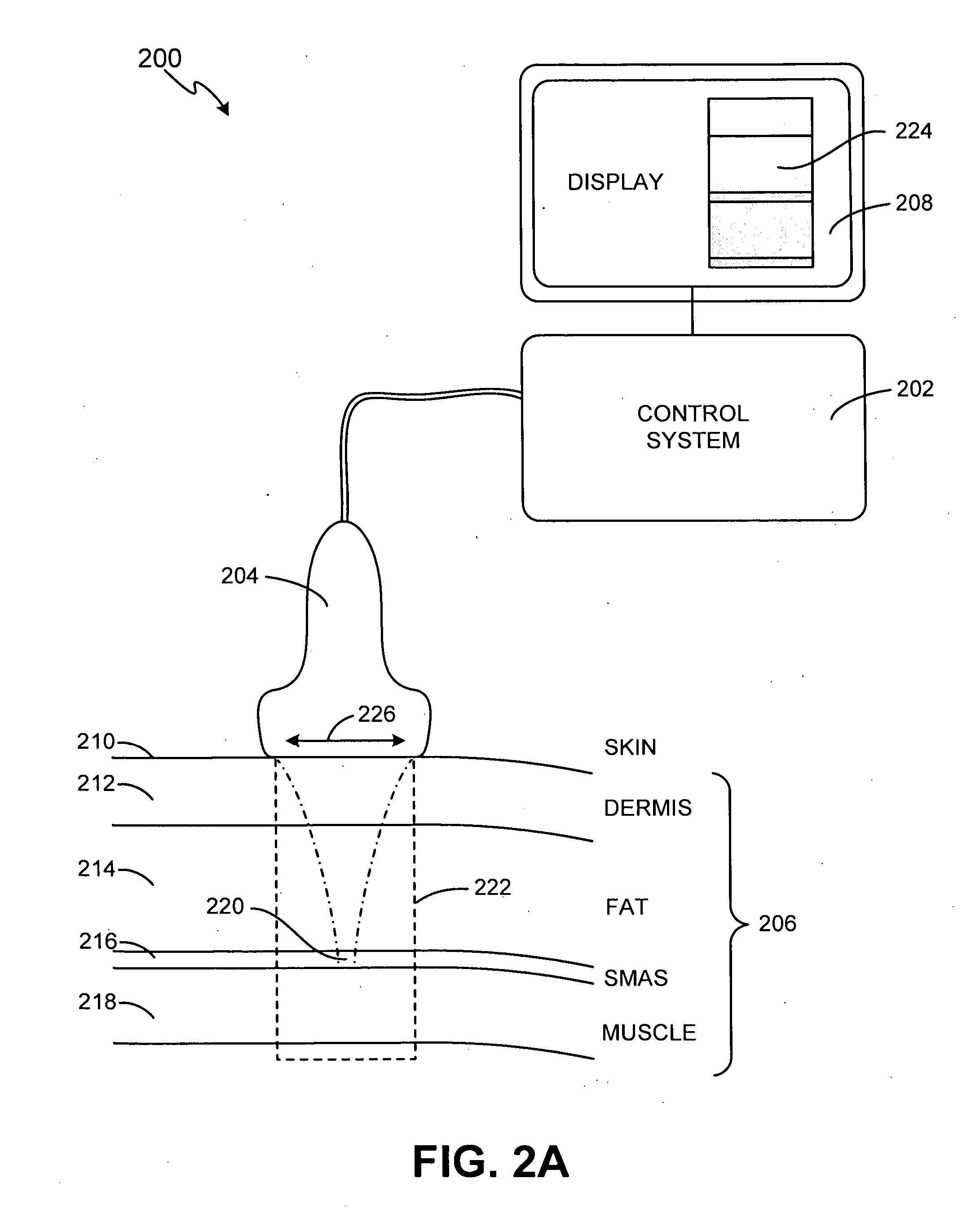 Method and system for noninvasive face lifts and deep tissue tightening