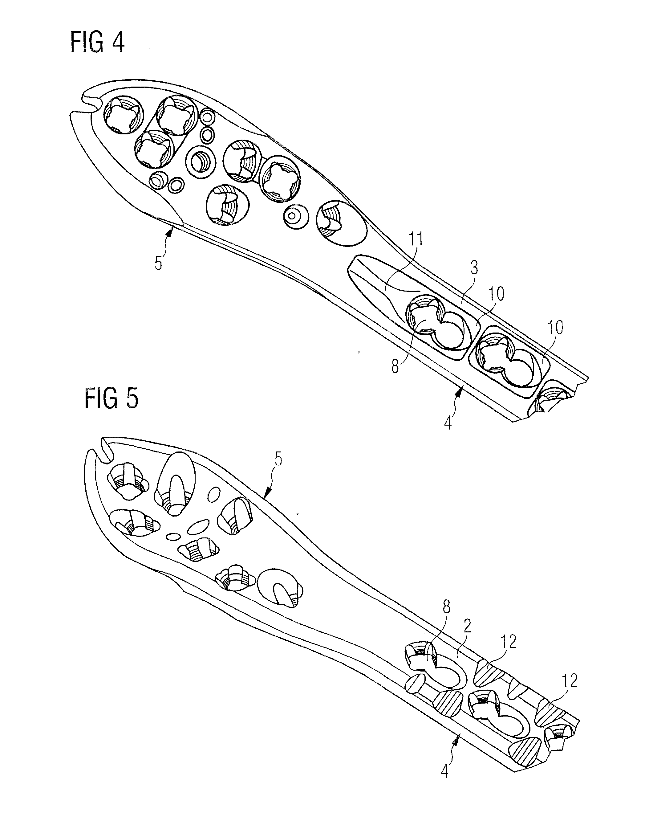 Bone Plate