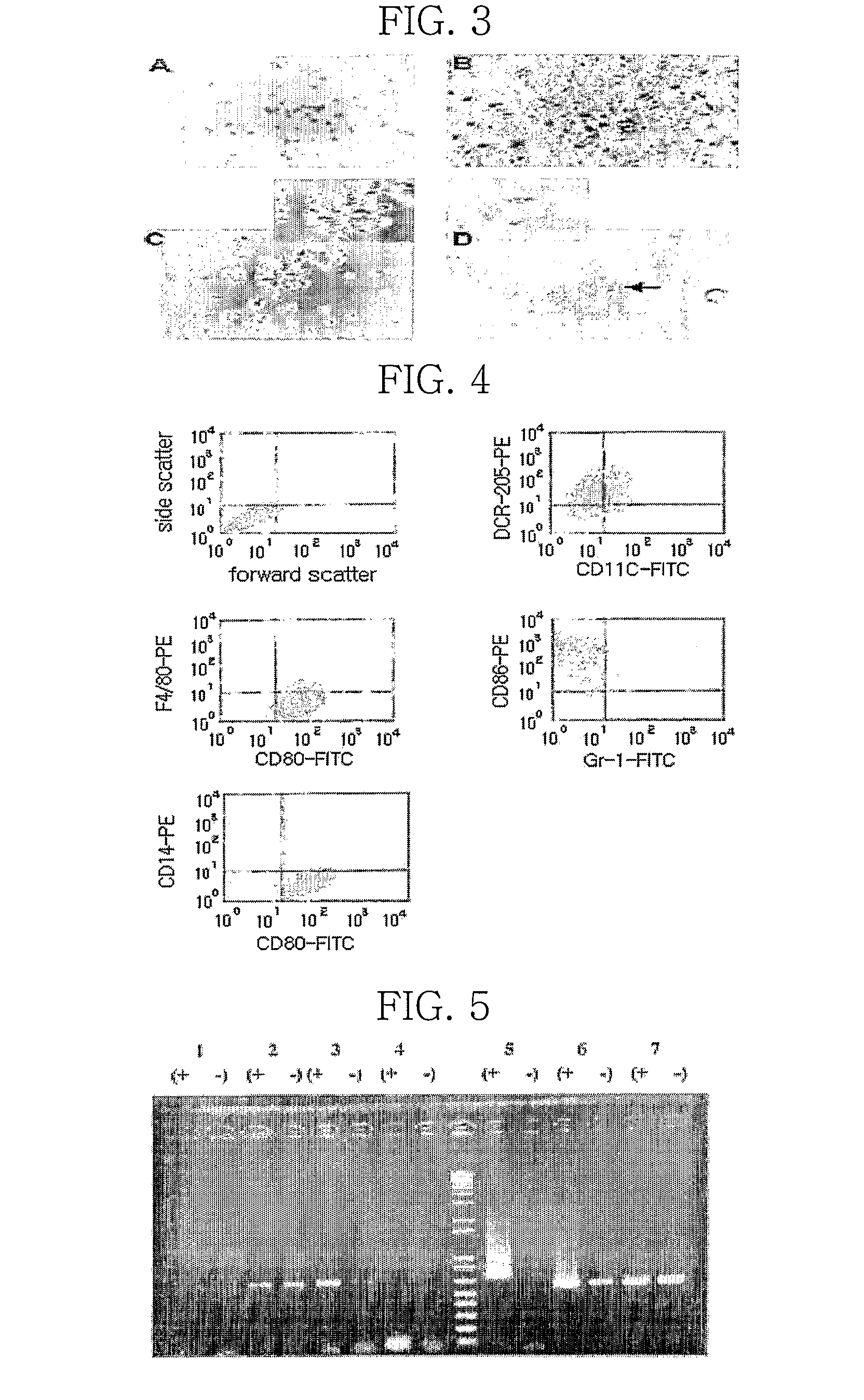 Monoacetyldiacylglycerol derivative for the treatment of sepsis