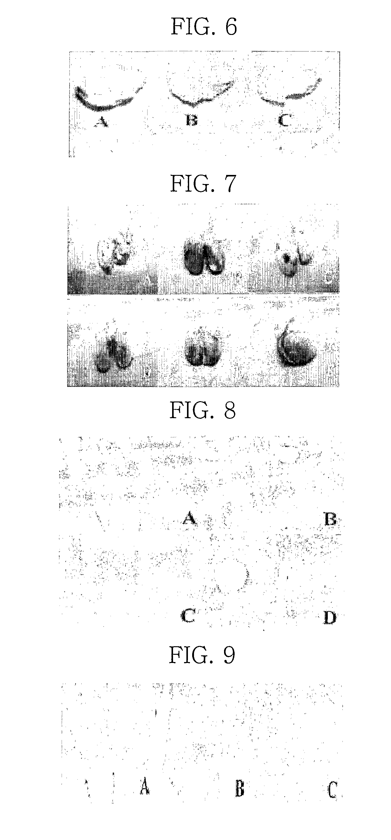 Monoacetyldiacylglycerol derivative for the treatment of sepsis