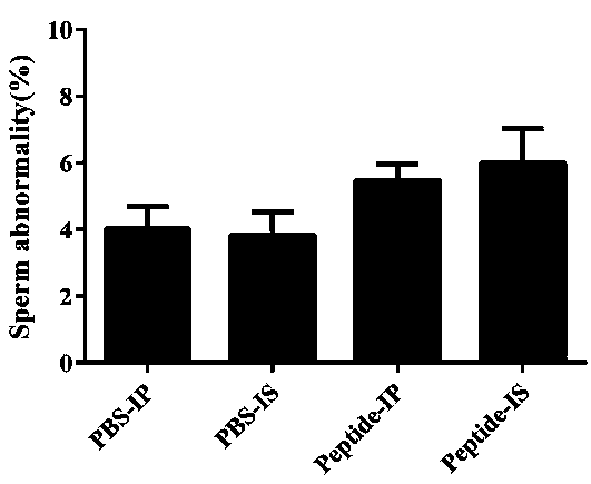 Polypeptide with male immunological contraception function and application of polypeptide