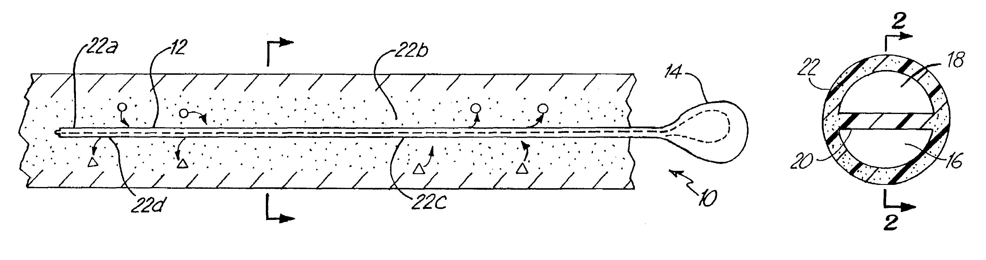 System and method for site specific therapy