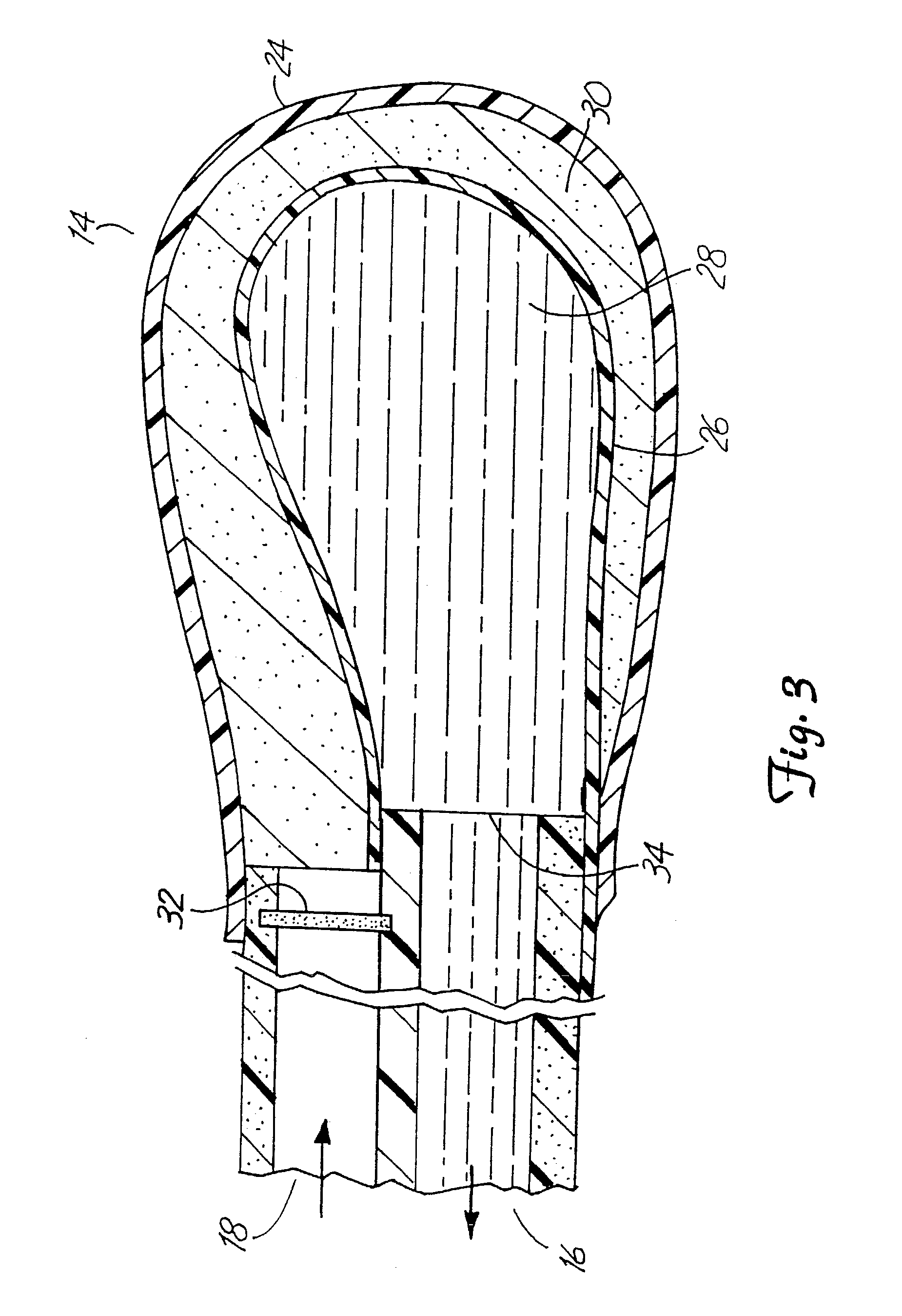 System and method for site specific therapy