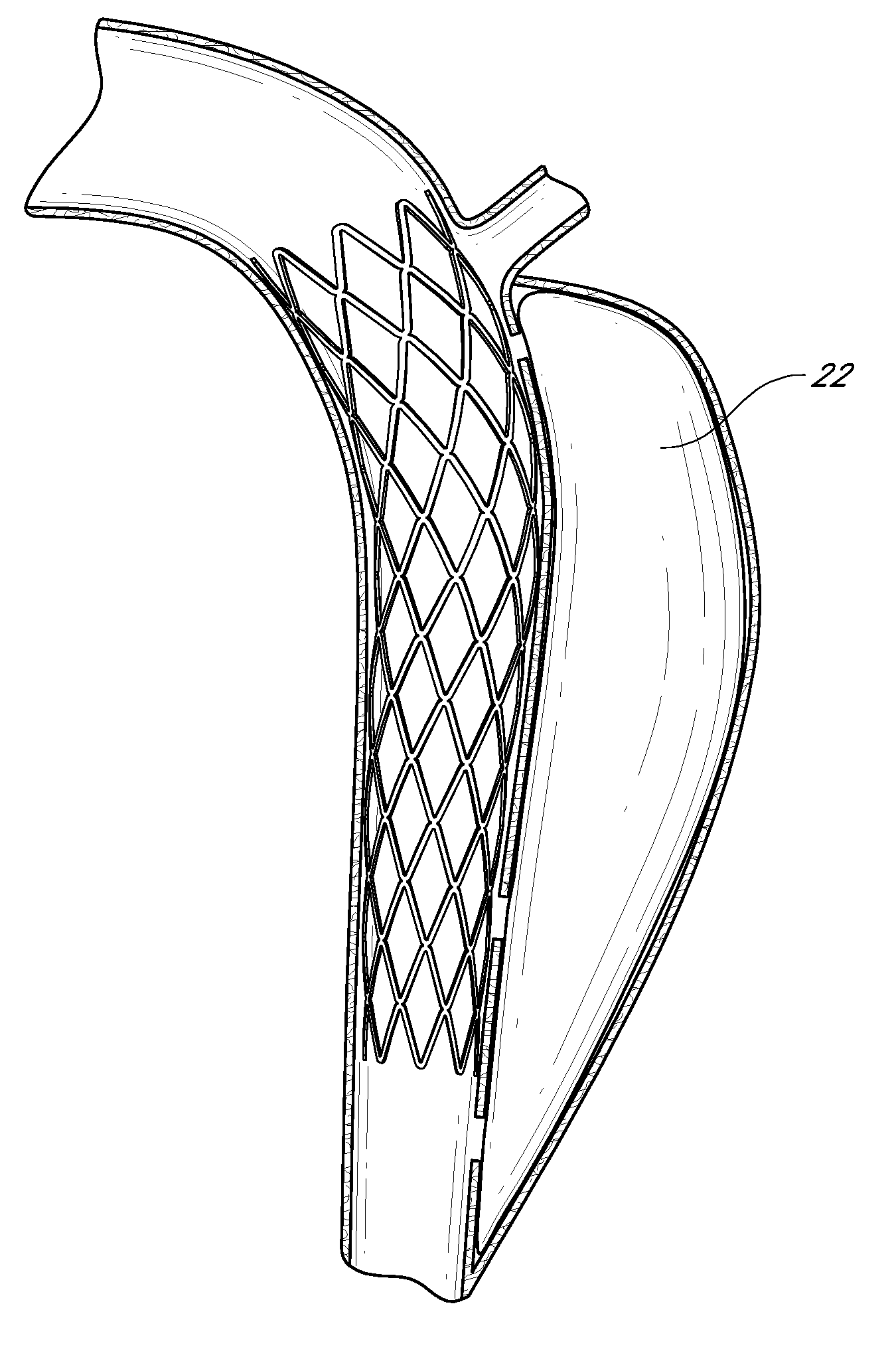 Devices and methods to treat vascular dissections