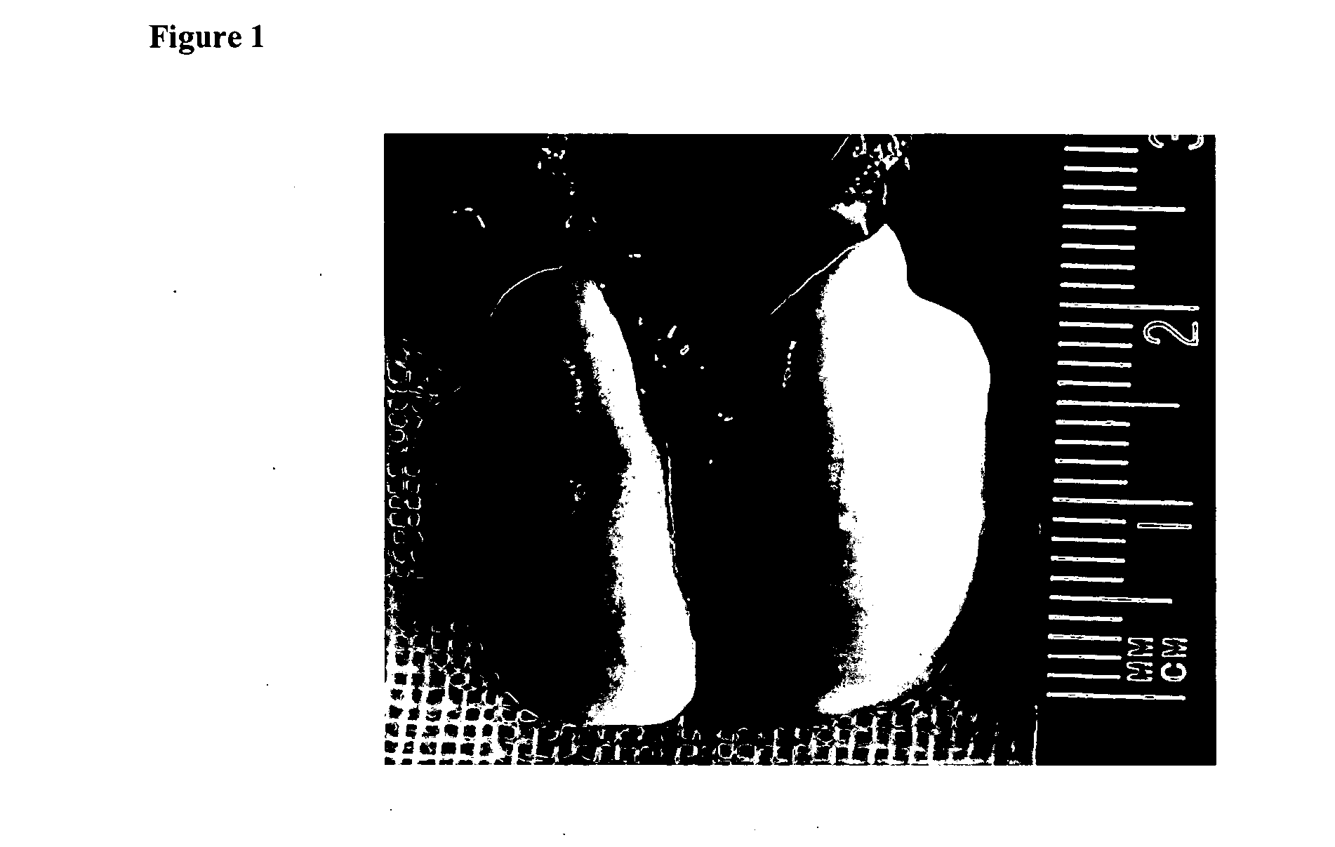 Compositions of flavonoids and flavonoid-containing extracts and the treatment of diseases