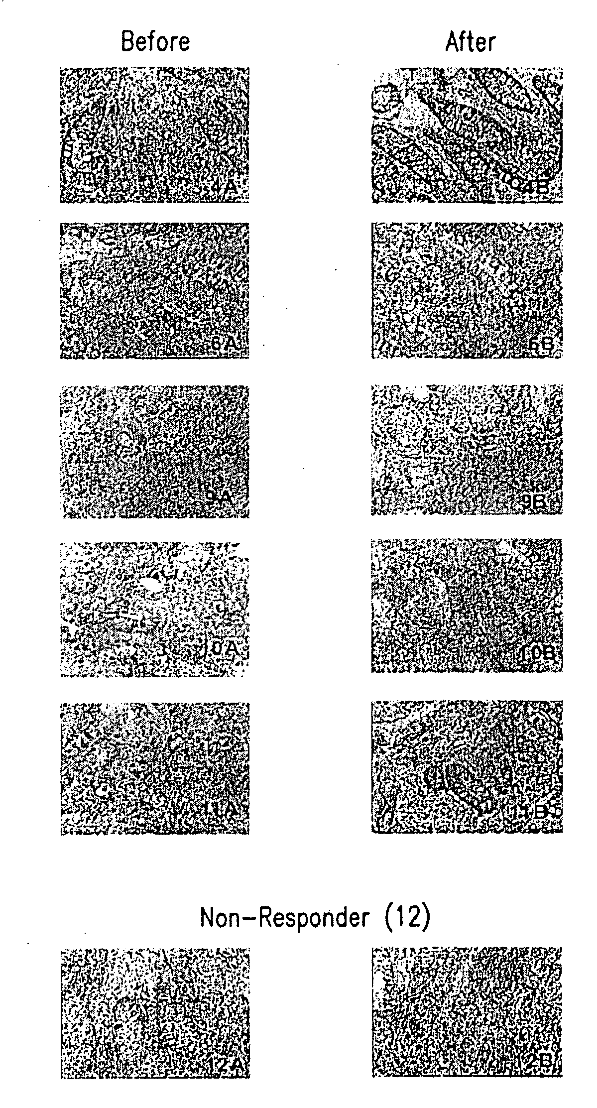 Guanylhydrazones in Methods of Treatment or Diagnosis as Modulators of Signal Transduction