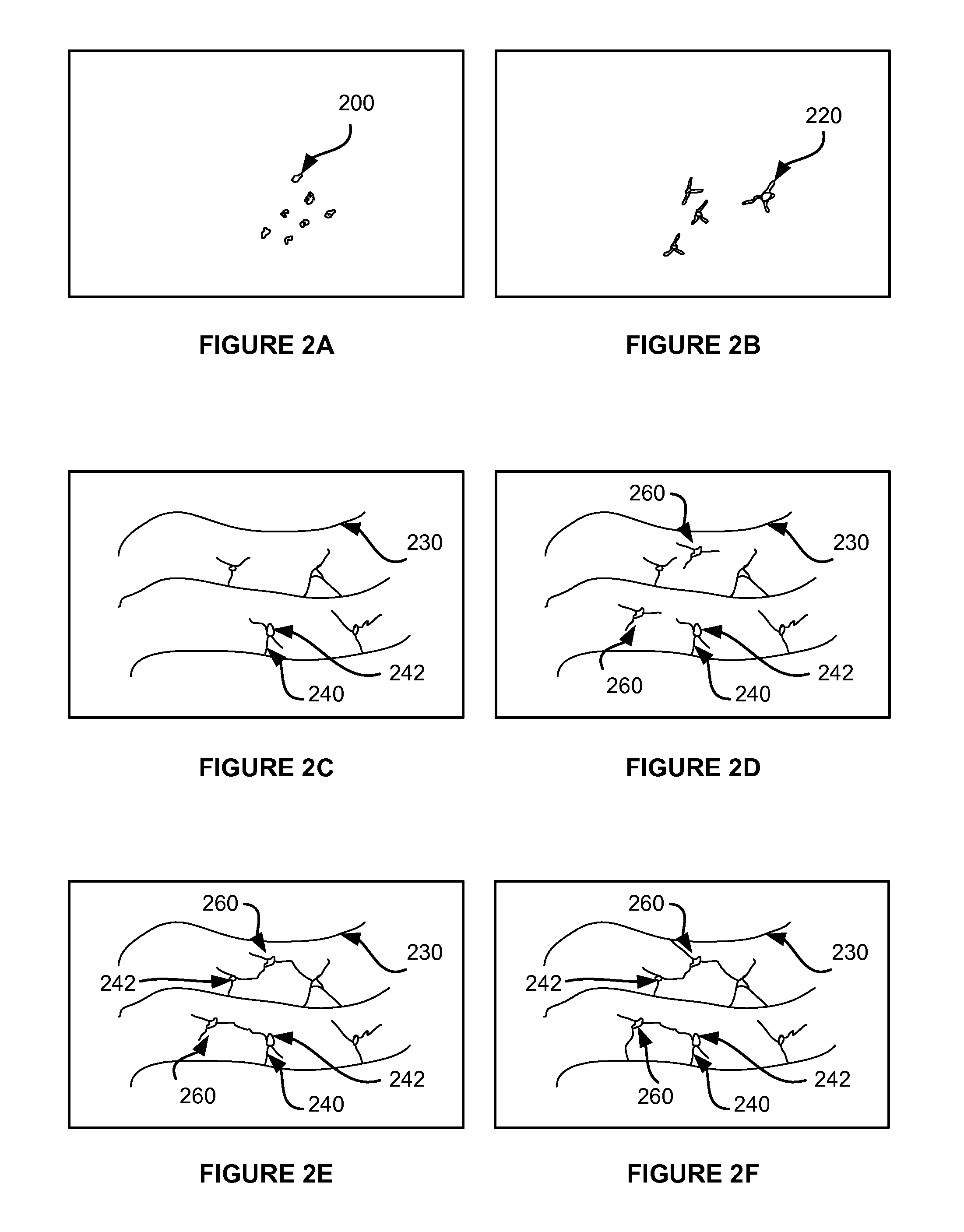 Device and Method of Minimally Invasive Tattooing and Tattoo Removal