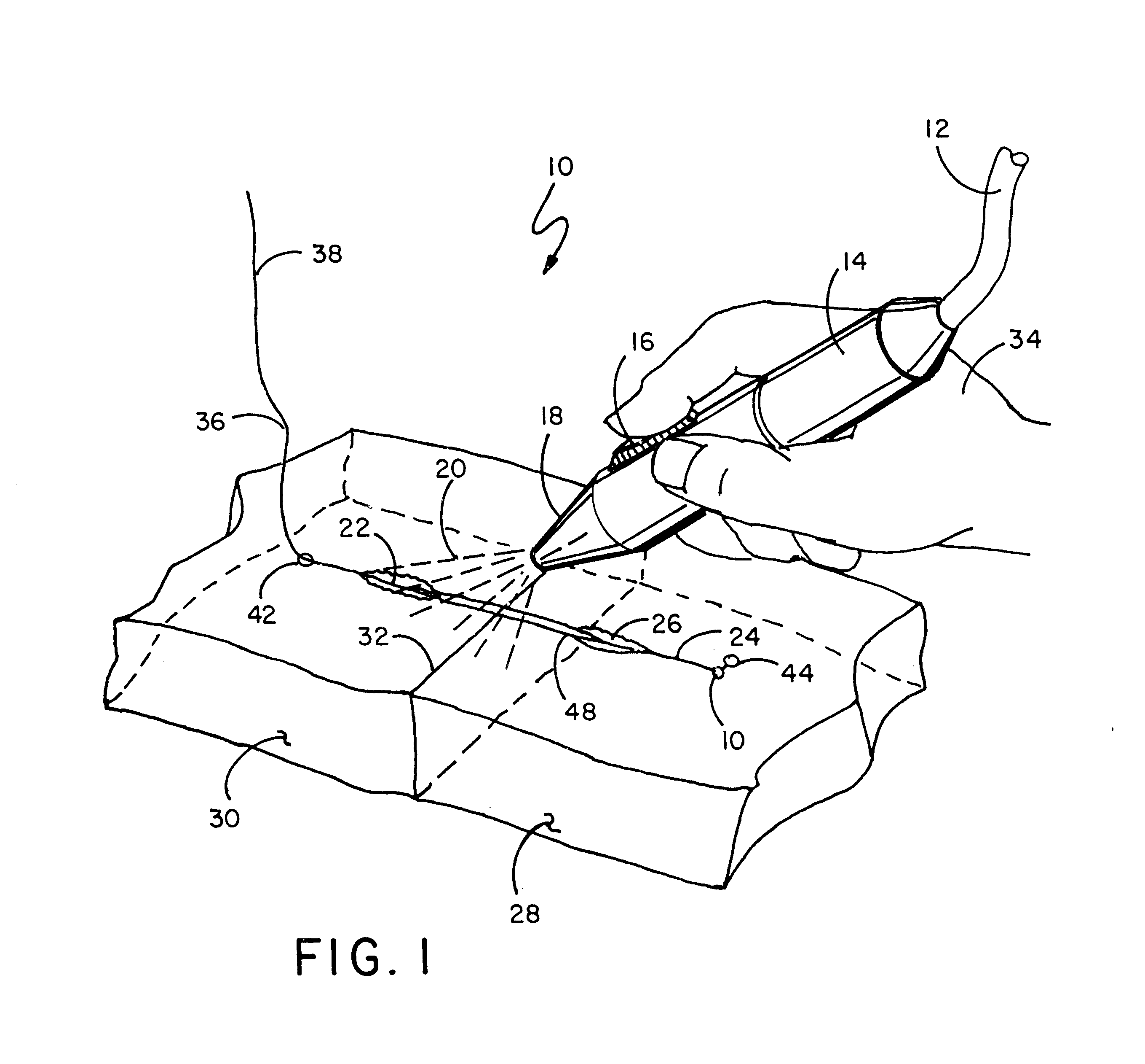 Suture and method of use