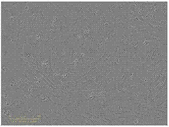 CD29&lt;+&gt; human umbilical cord-derived mesenchymal stem cell and application thereof in preparation of bone tissue engineering seed cell used for treating bone injury