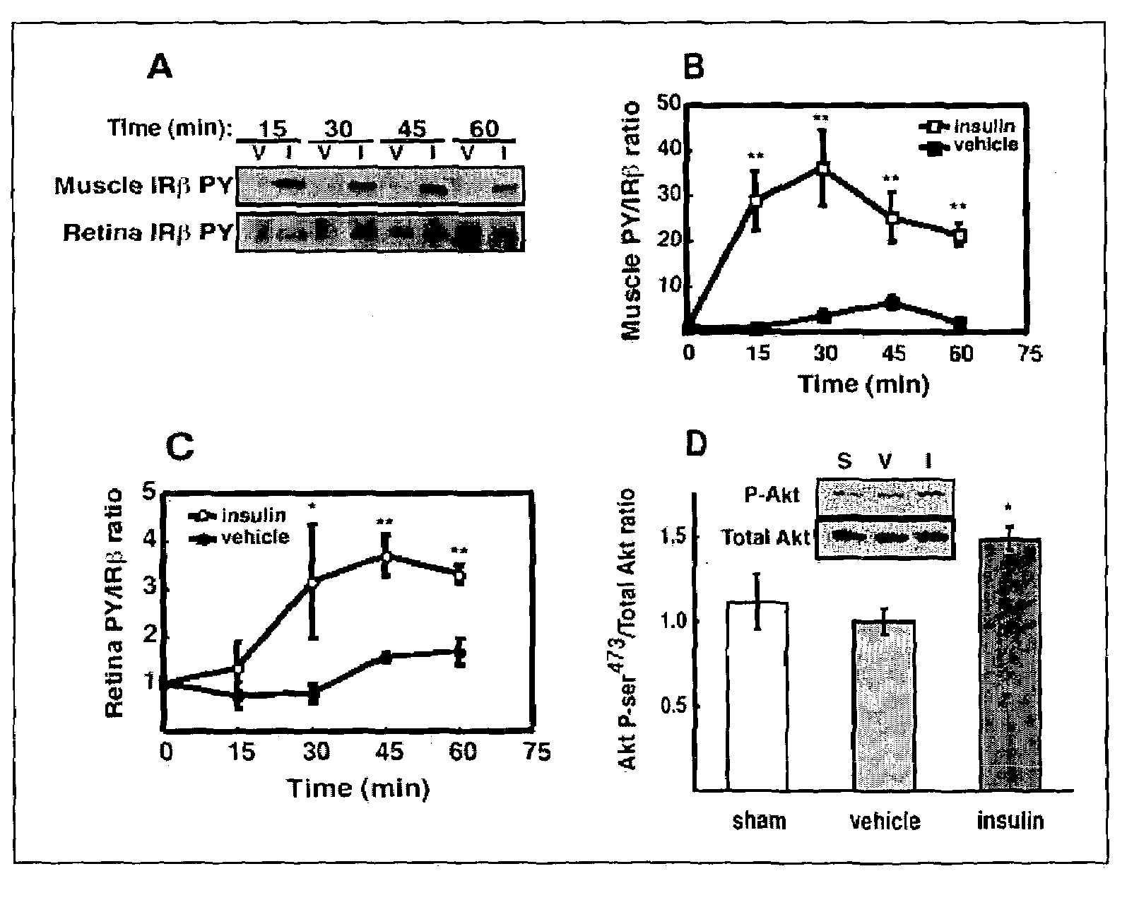 Periocular drug delivery for diabetic retinopathy