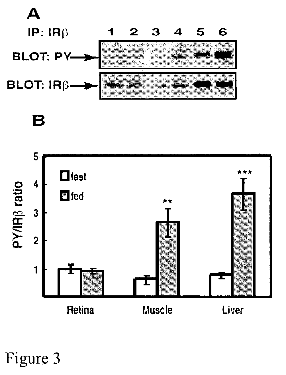 Periocular drug delivery for diabetic retinopathy