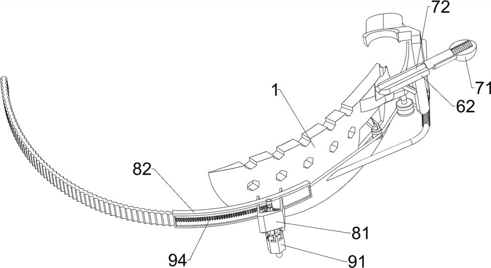 Mouth opening device for impacted tooth extraction