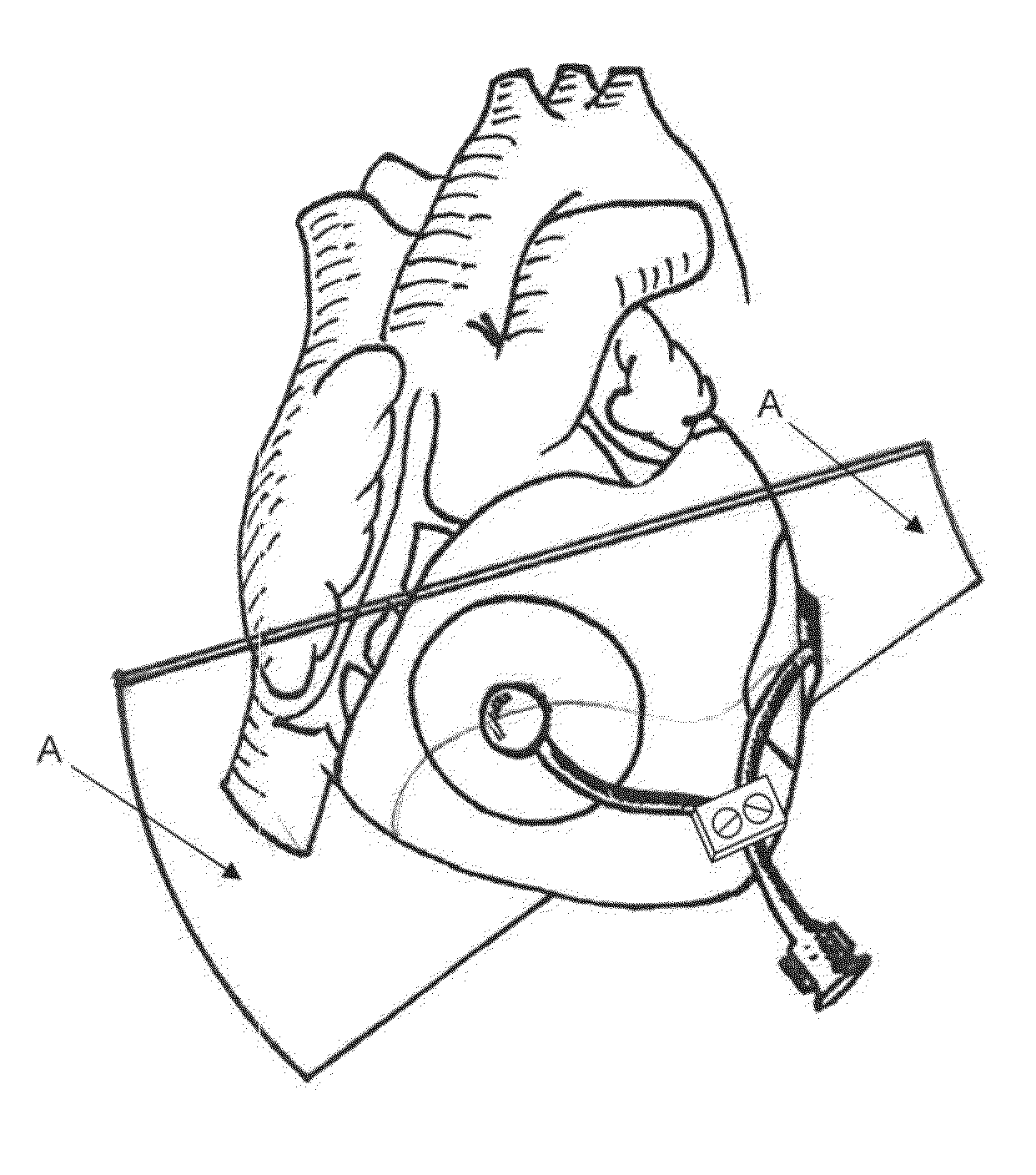 Cardiac compression system