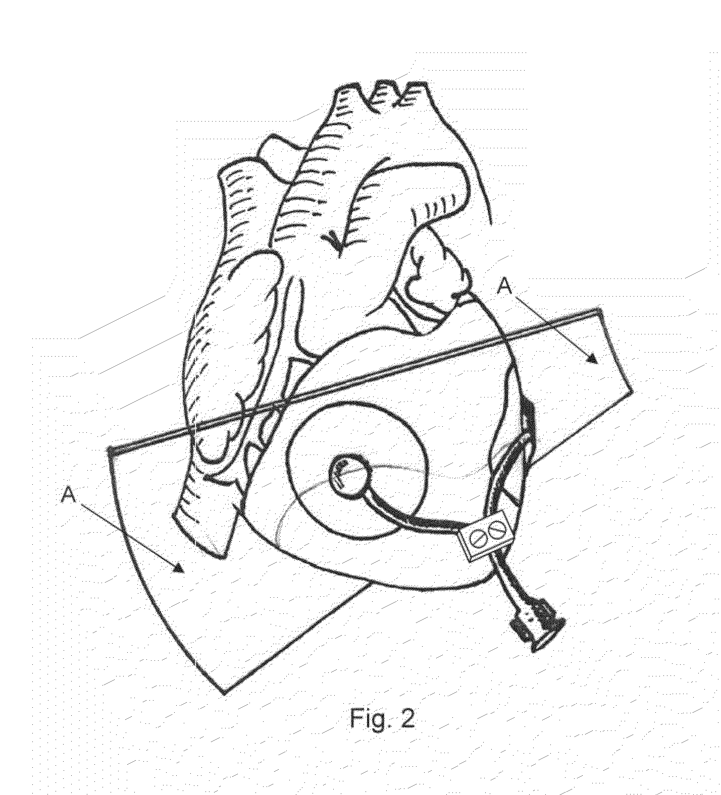 Cardiac compression system