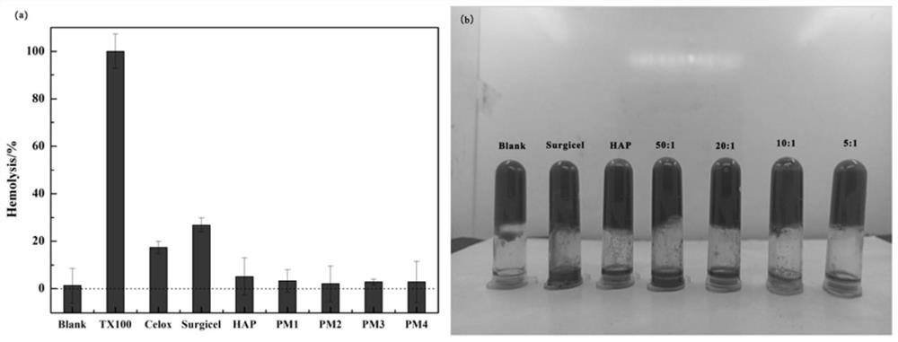 Nano-hydroxyapatite/polydopamine wet-adhesive hemostatic powder for external use and preparation method thereof