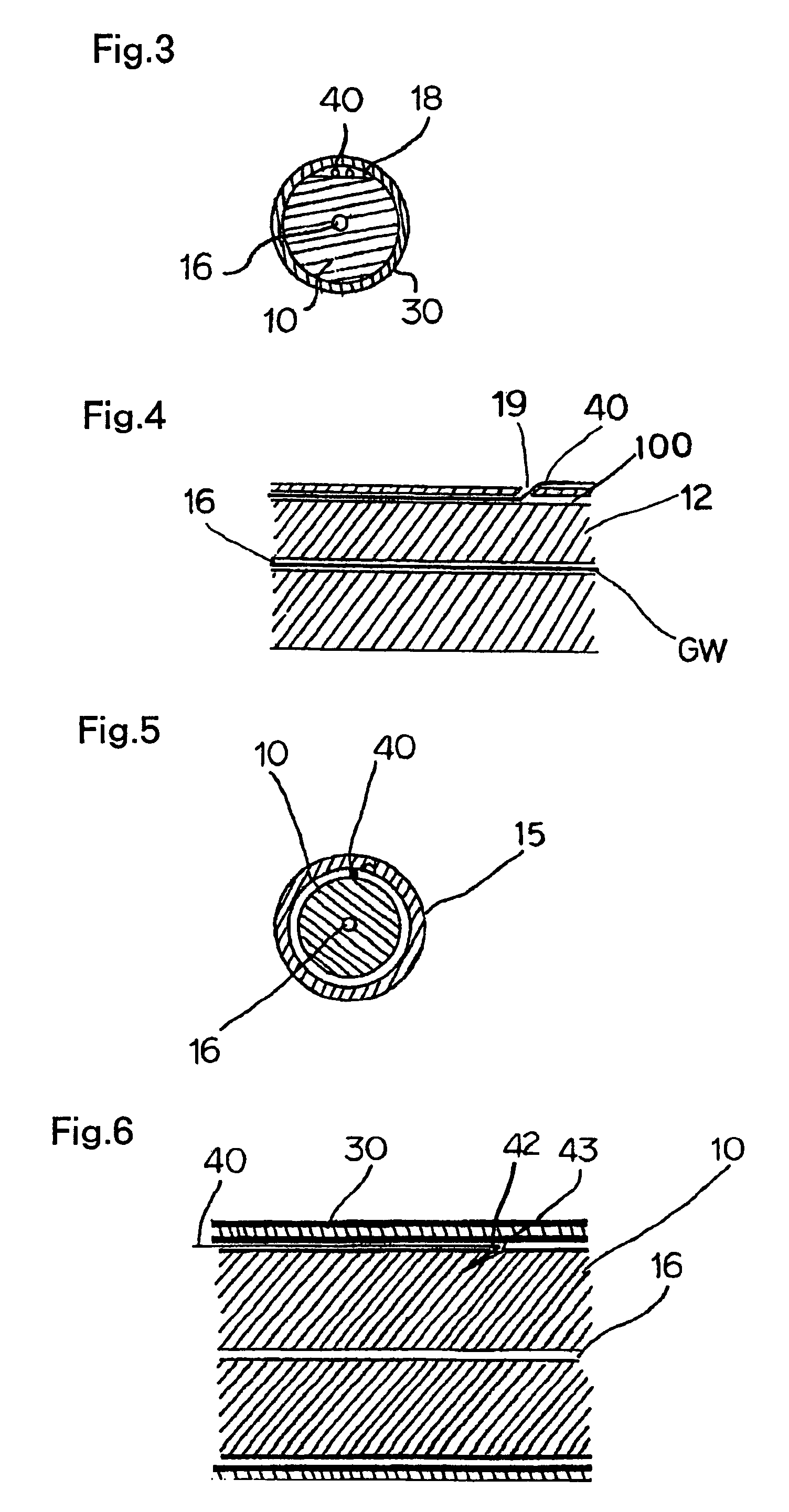 Stent graft indwelling device and fixed chip