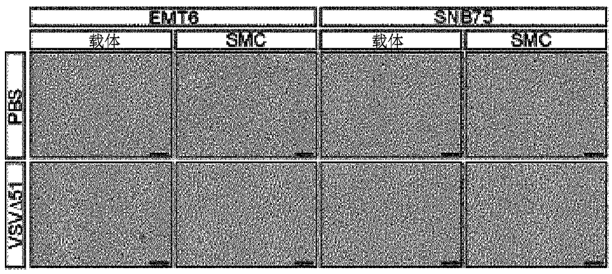 Smc combination therapy for treatment of cancer