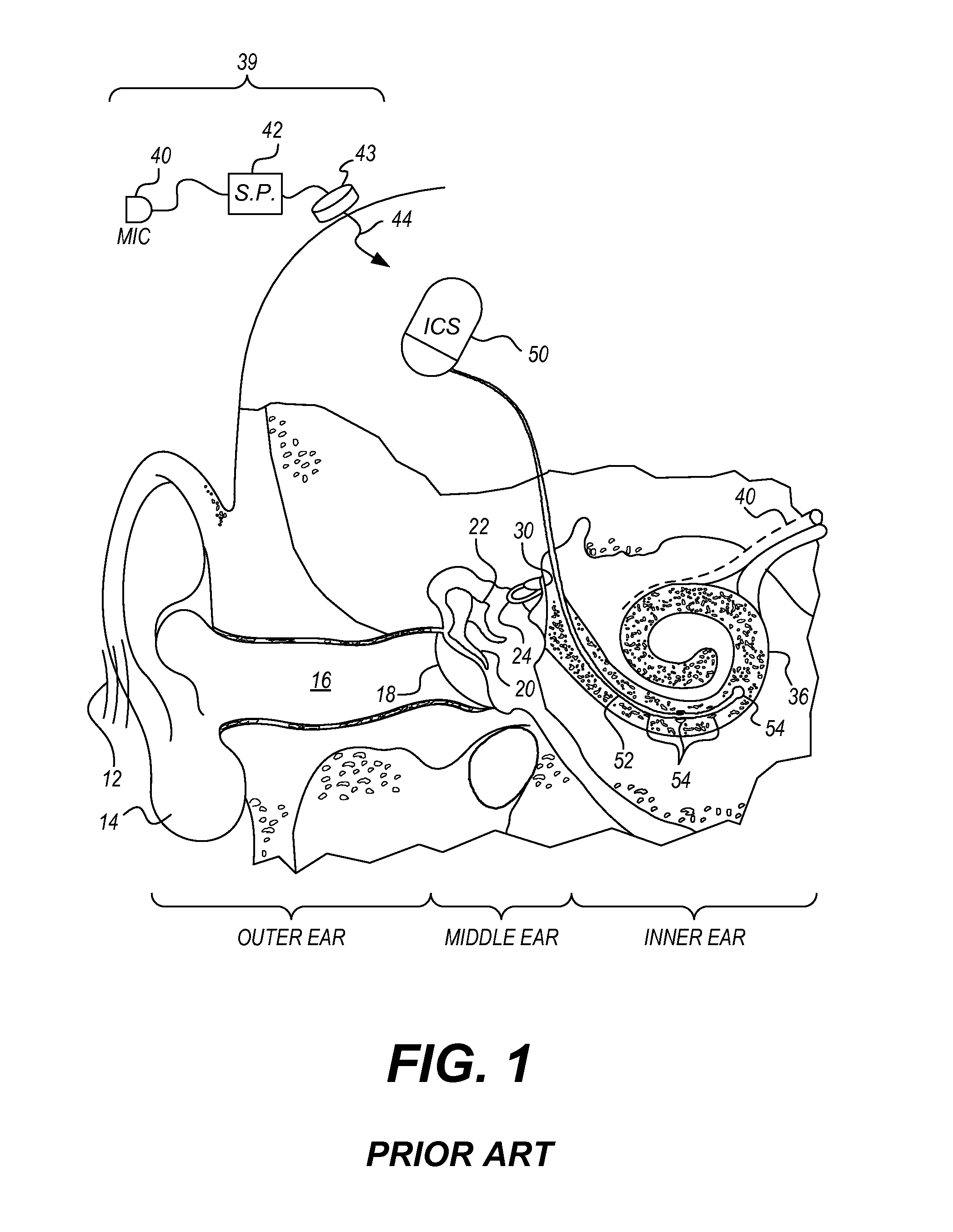 Dual microphone EAS system that prevents feedback