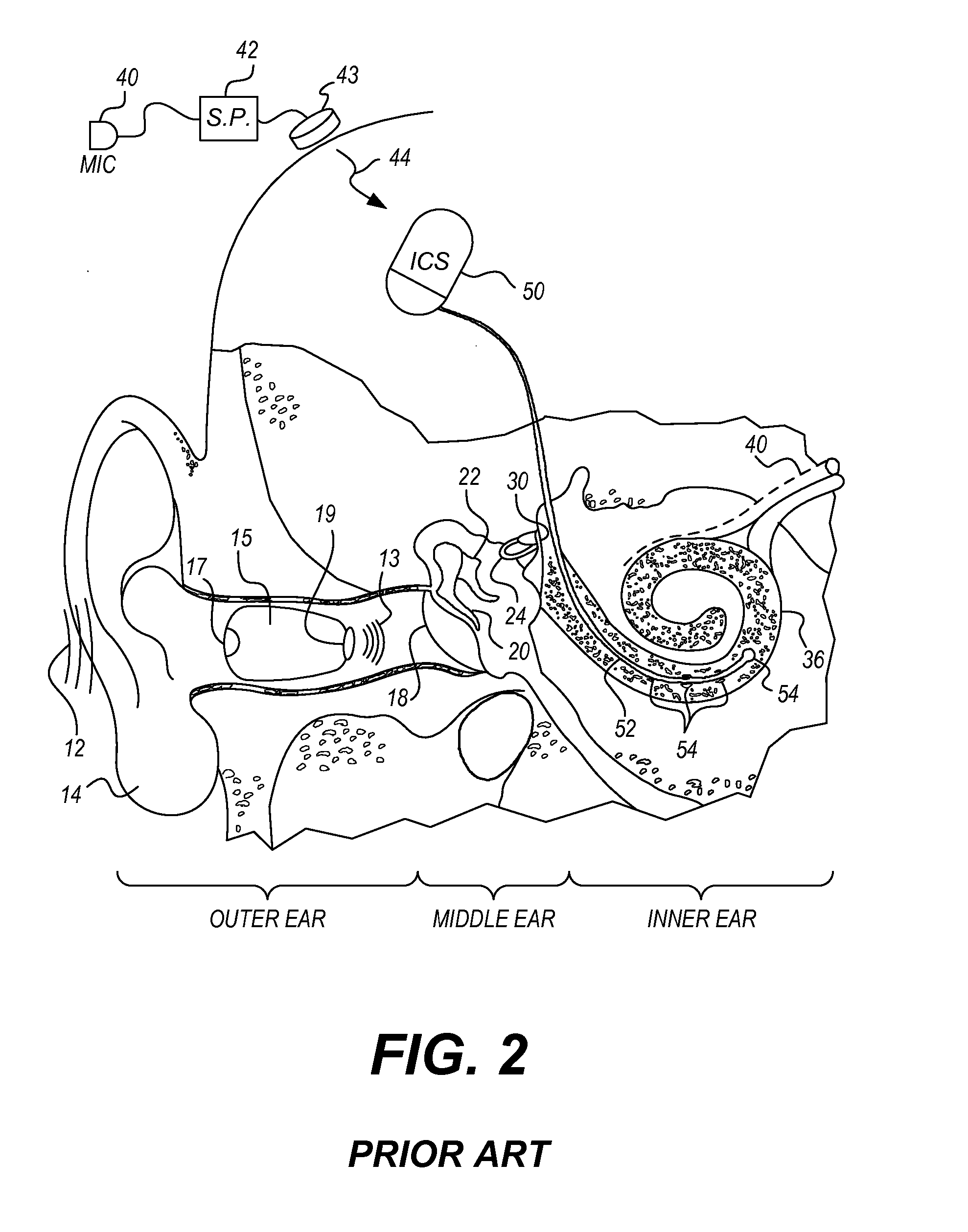 Dual microphone EAS system that prevents feedback