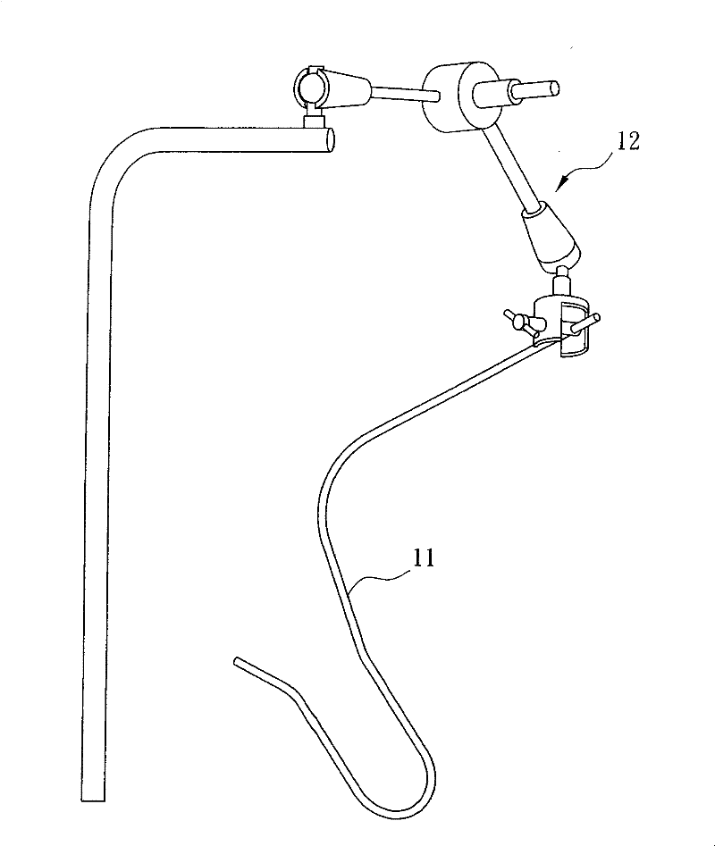 Intra-abdominal organ suspension device