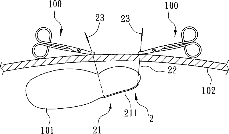 Intra-abdominal organ suspension device