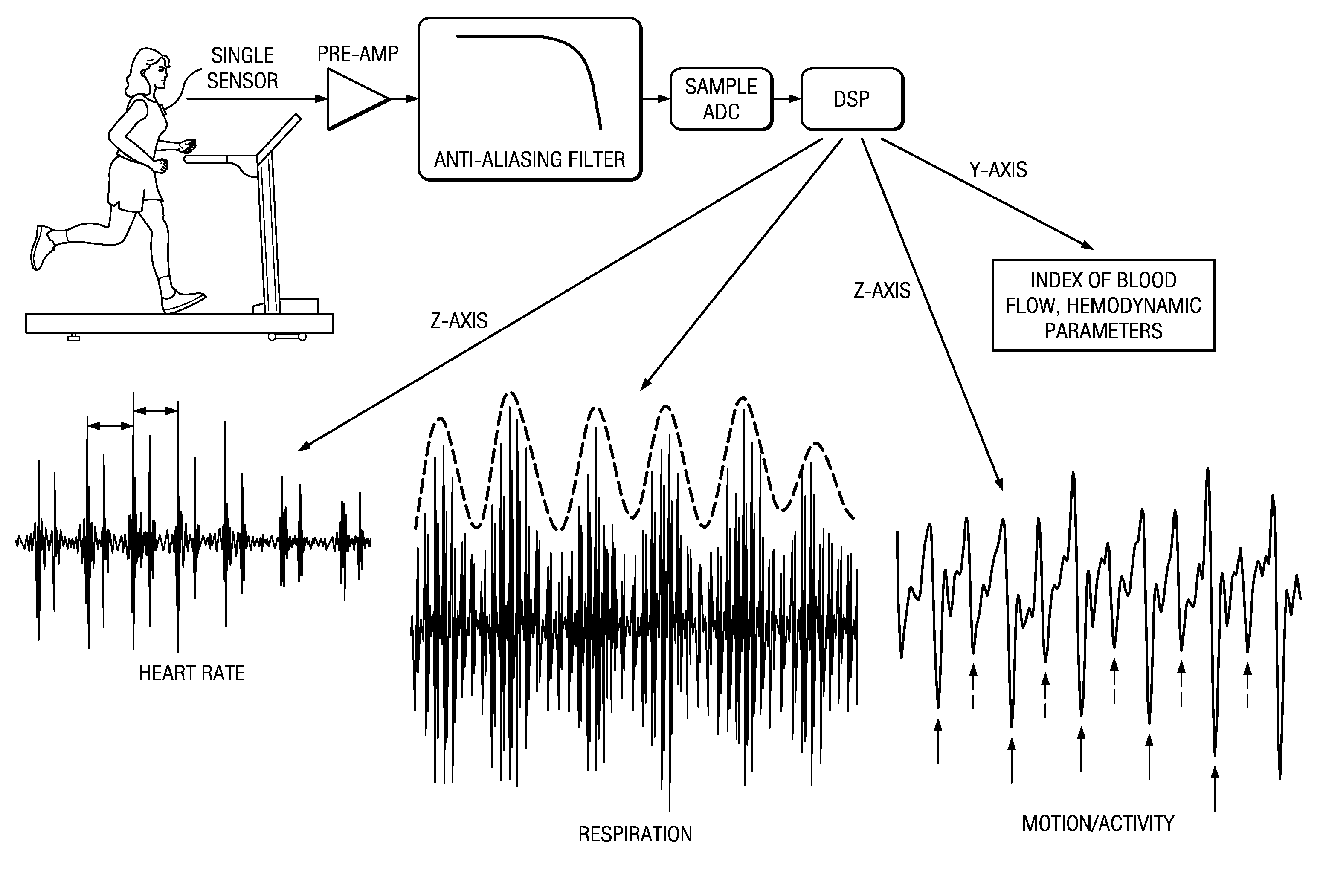 Heart monitors and processes with accelerometer motion artifact cancellation, and other electronic systems