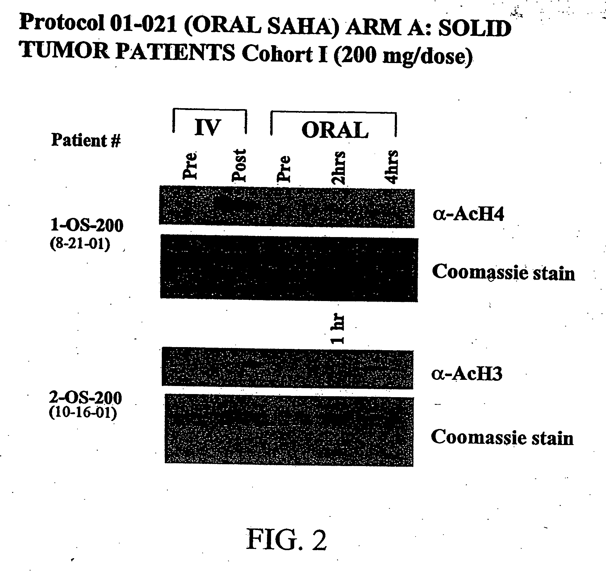 Methods of treating cancer with HDAC inhibitors