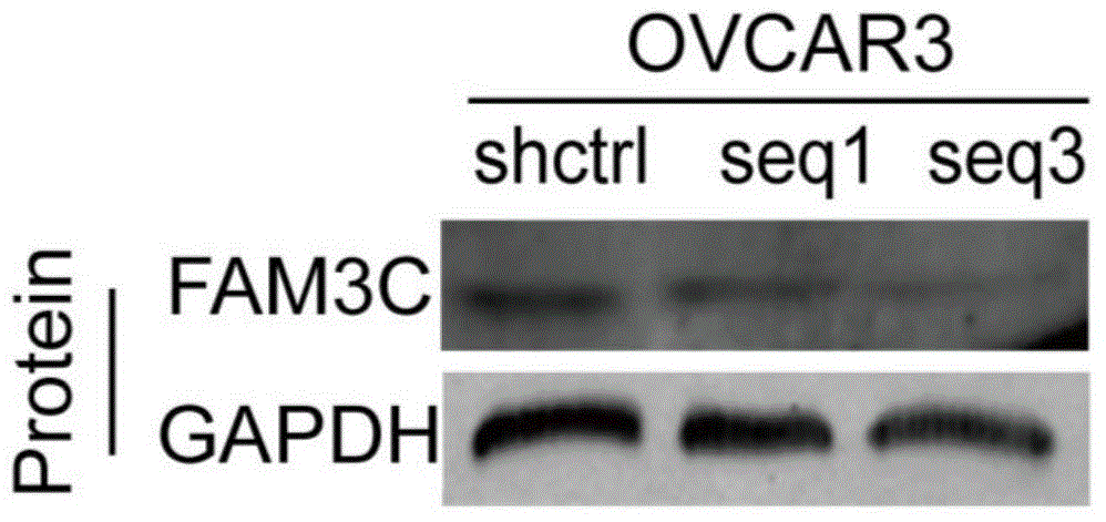 Application of FAM3C antisense nucleotide in preparation of drugs for inhibiting epithelial ovarian cancer cell invasion and metastasis