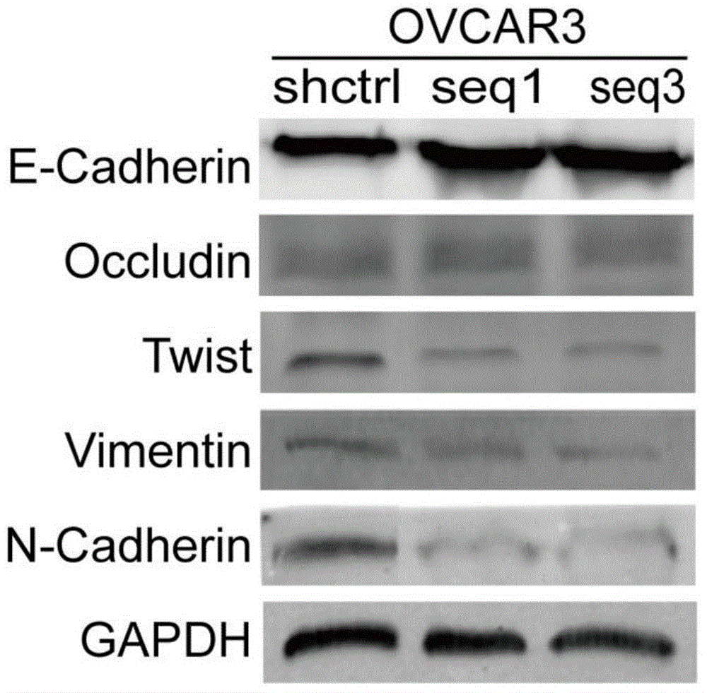 Application of FAM3C antisense nucleotide in preparation of drugs for inhibiting epithelial ovarian cancer cell invasion and metastasis