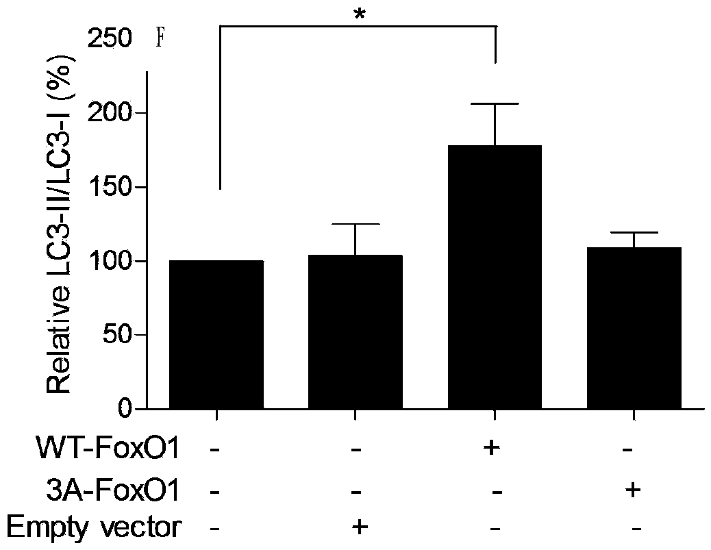 Use of epigallocatechin gallate (EGCG) in preparation of food and drug for preventing and treating myocardial energy metabolism disorders