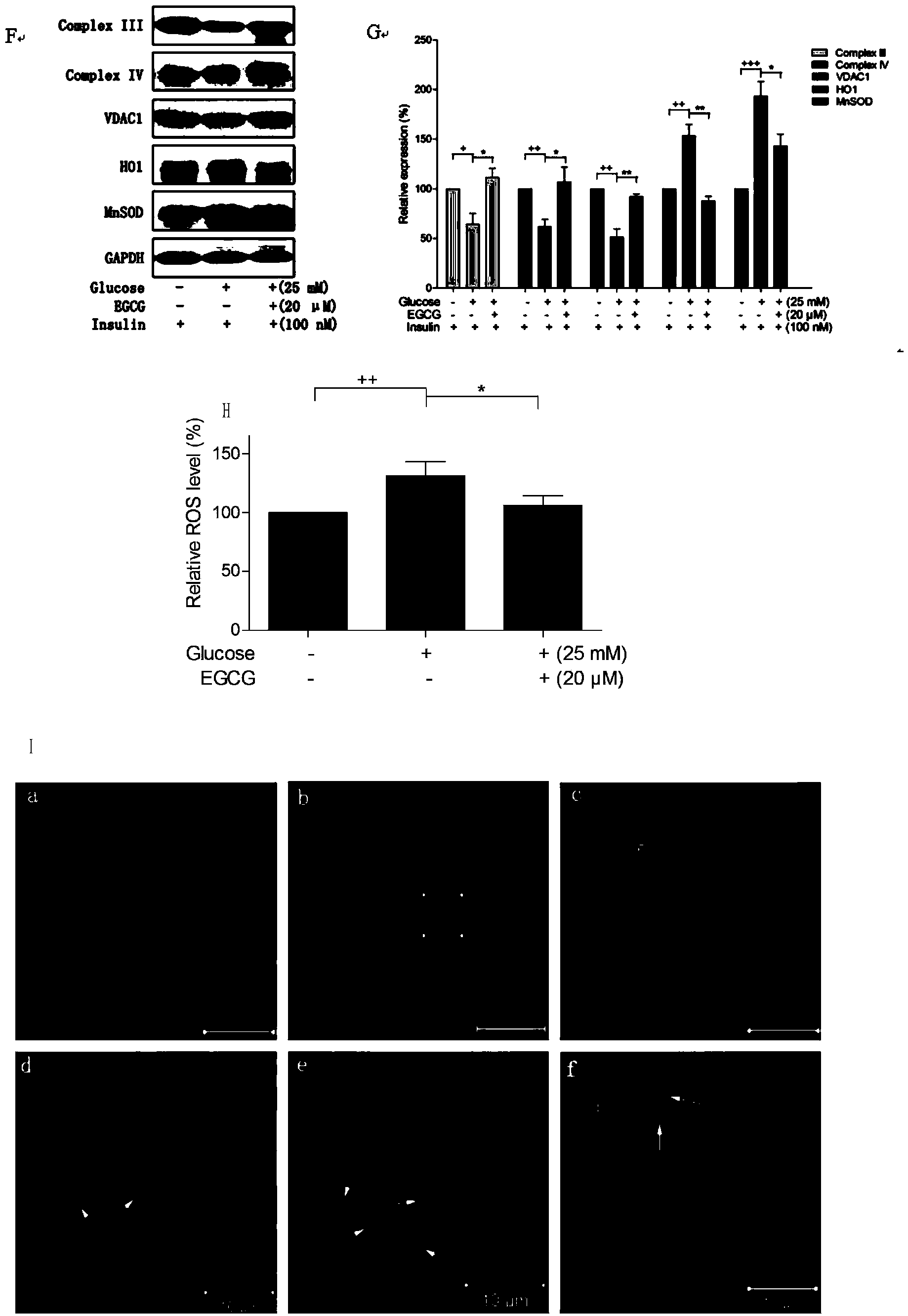 Use of epigallocatechin gallate (EGCG) in preparation of food and drug for preventing and treating myocardial energy metabolism disorders