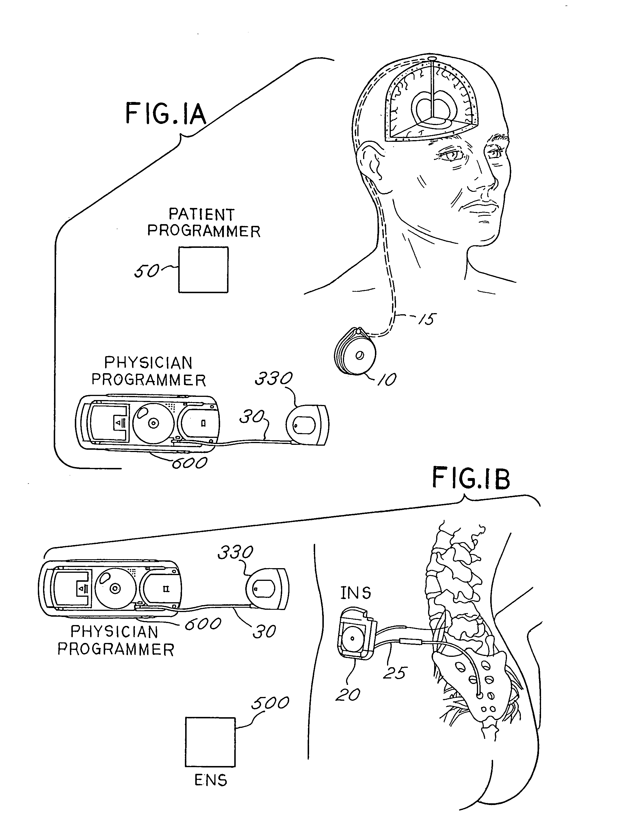 Method and apparatus for connecting various implantable medical treatment system component devices