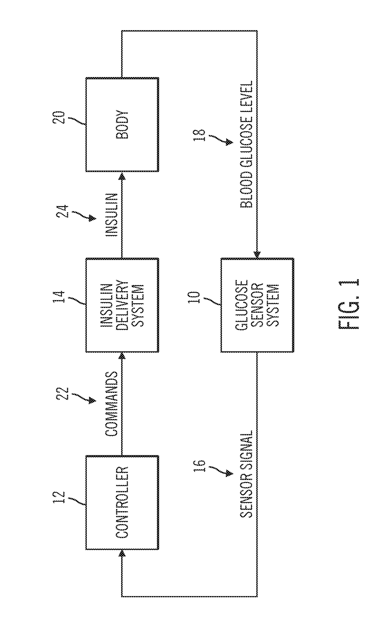 Sensor model supervisor for a closed-loop insulin infusion system