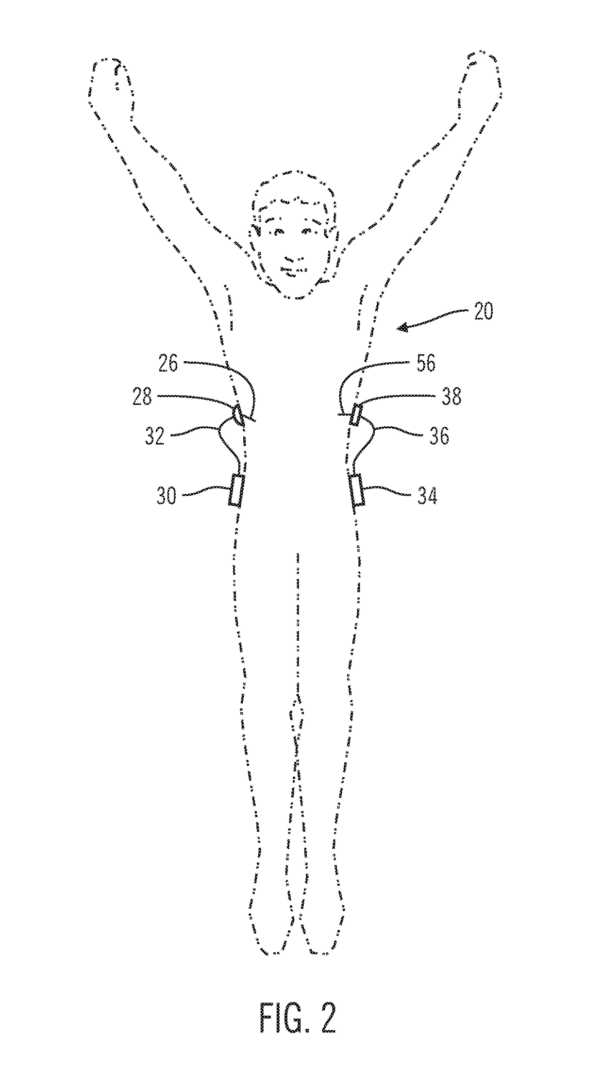 Sensor model supervisor for a closed-loop insulin infusion system