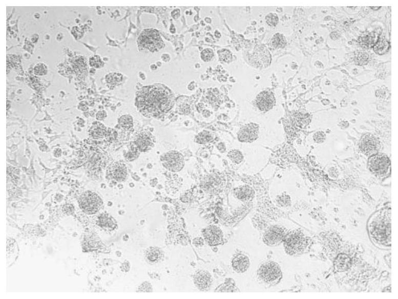 A kind of duck reovirus causing duck spleen necrosis and its inactivated vaccine and application