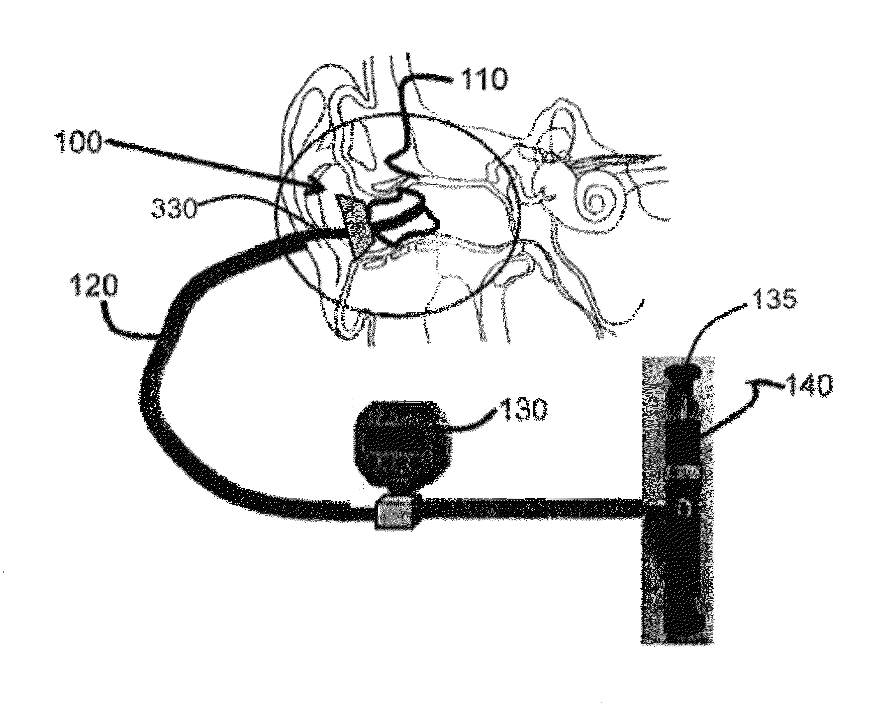 Device and method for radial pressure determination