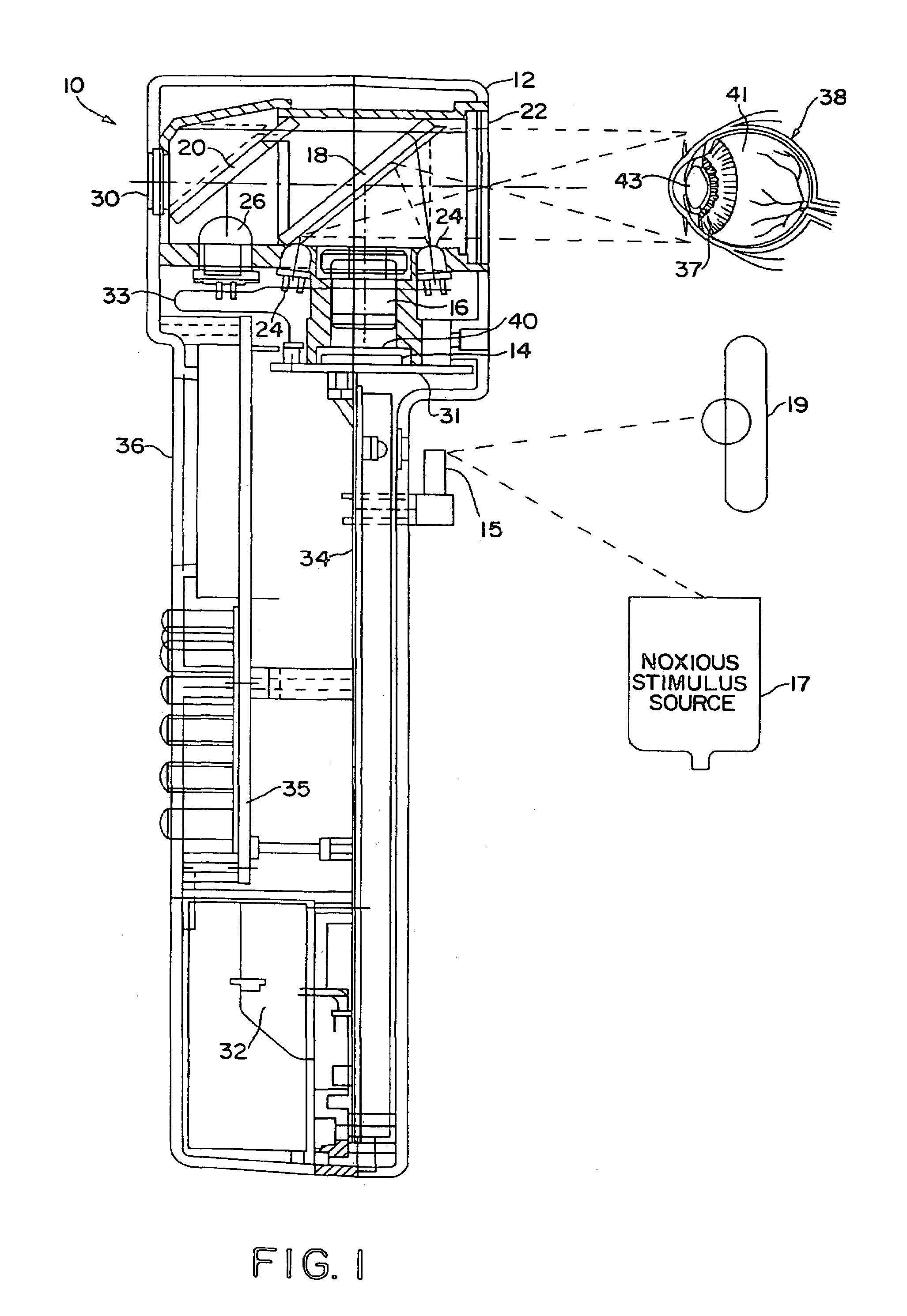 Pupilometer with pupil irregularity detection, pupil tracking, and pupil response detection capability, glaucoma screening capability, intracranial pressure detection capability, and ocular aberration measurement capability