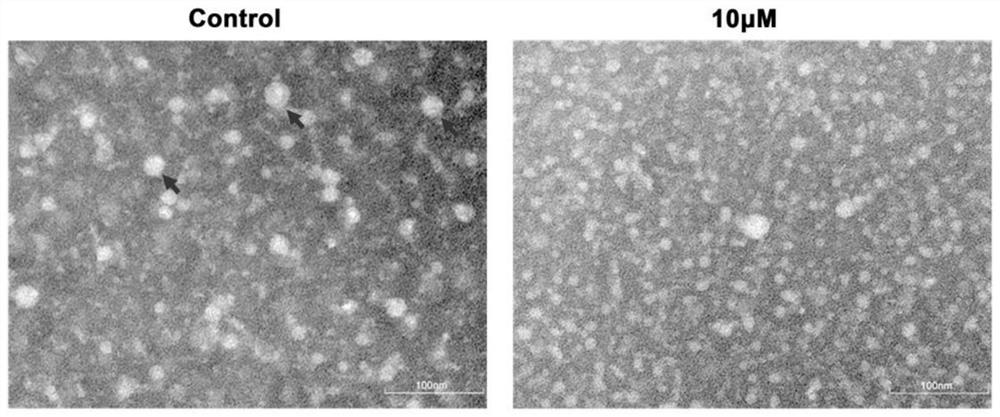 Application of benzimidazole compound in preparation of anti-hepatitis B virus drugs