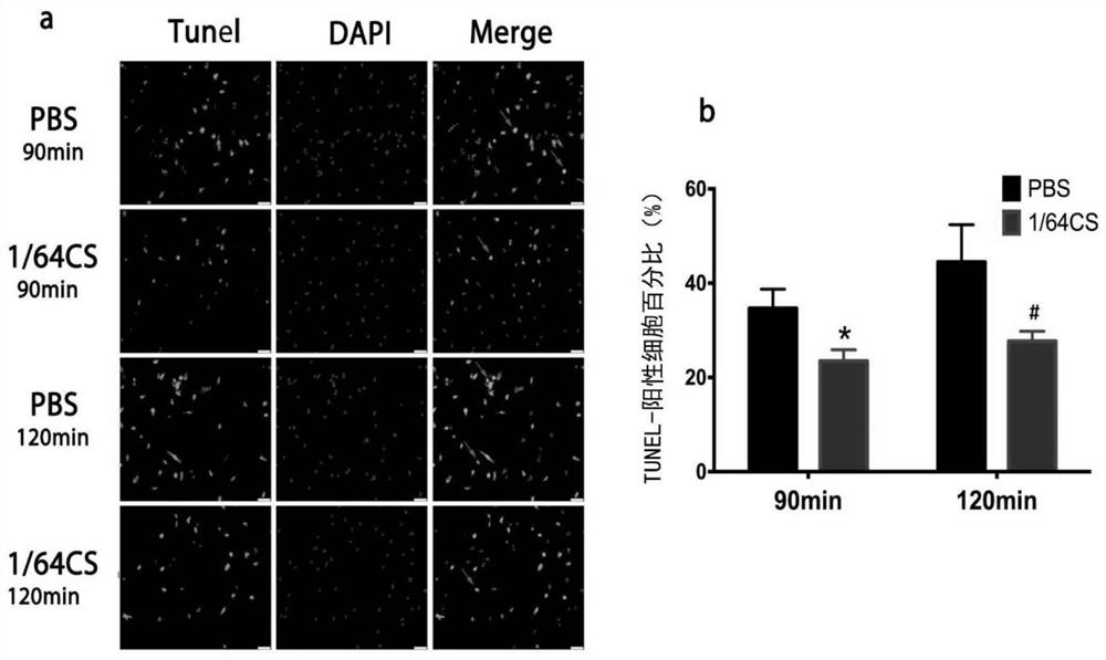 An ionic reagent capable of treating myocardial infarction and its preparation method and application