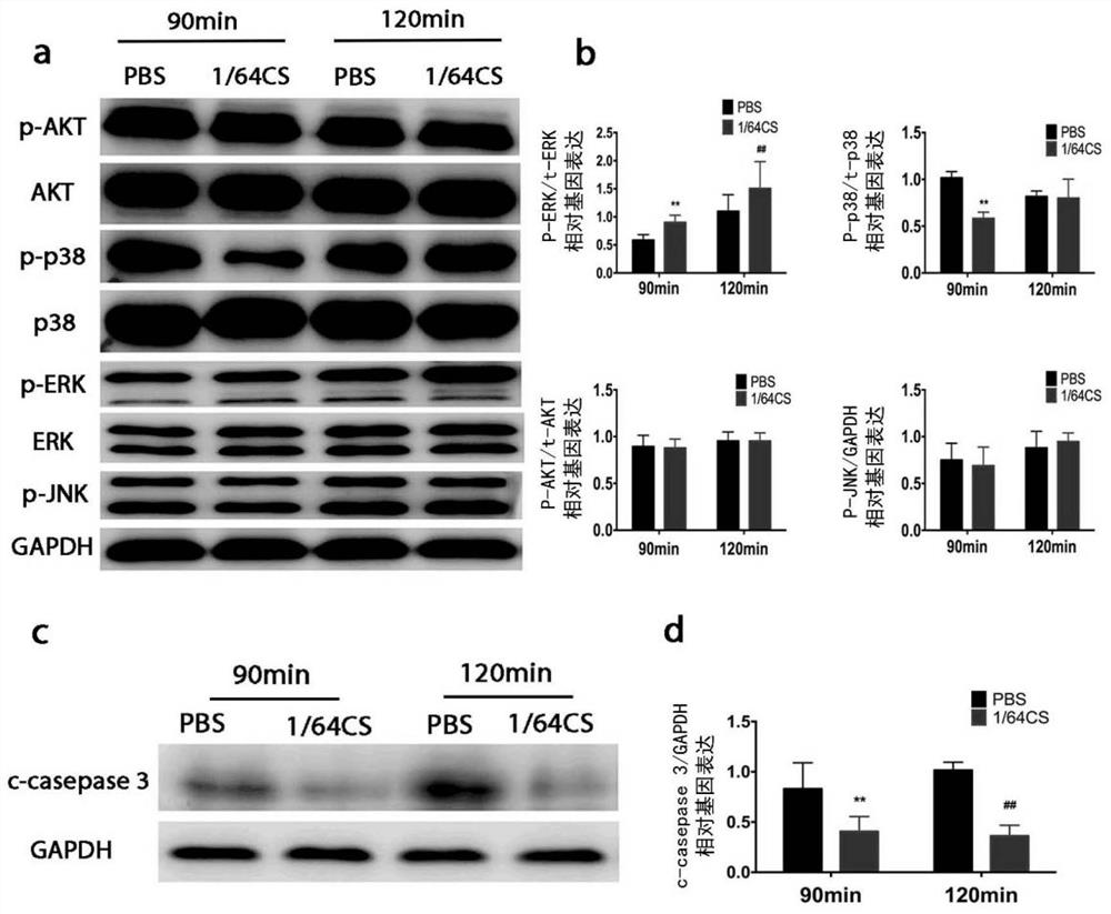 An ionic reagent capable of treating myocardial infarction and its preparation method and application