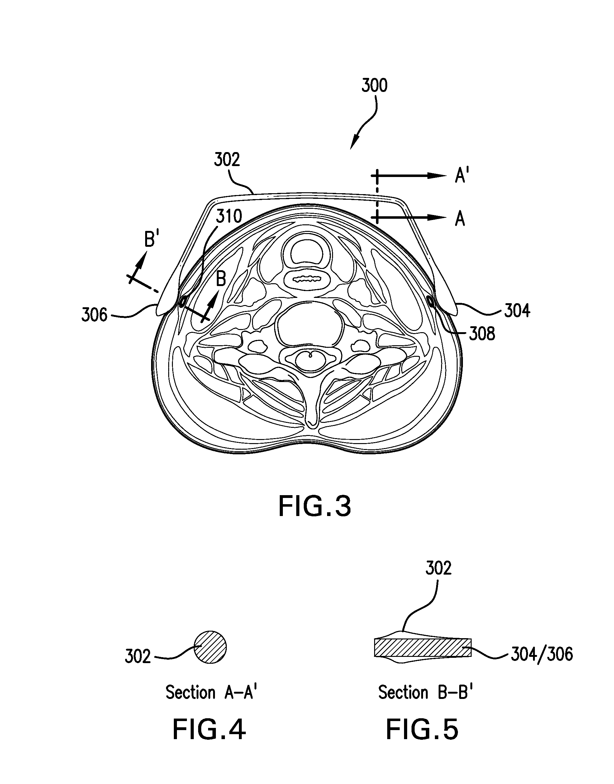 C-tourniquet